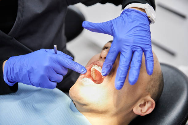 Best Emergency Root Canal Treatment in Middleton, WI